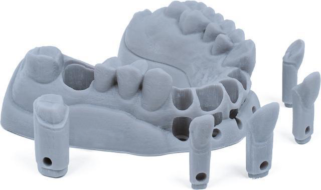 Specific application examples of 3D printing in digital dentistry