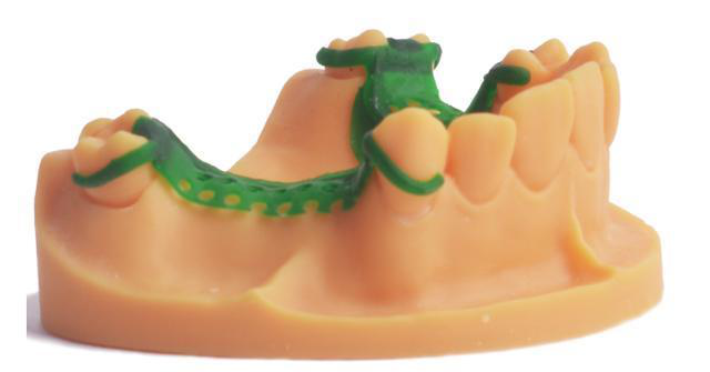 Specific application examples of 3D printing in digital dentistry(图2)