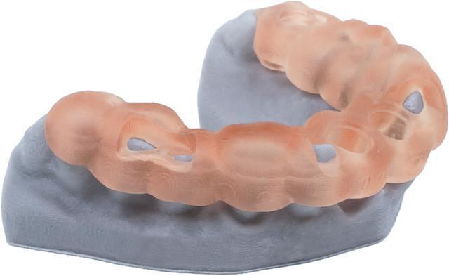 Specific application examples of 3D printing in digital dentistry(图1)