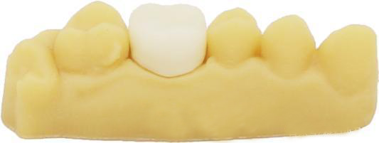 Specific application examples of 3D printing in digital dentistry(图7)